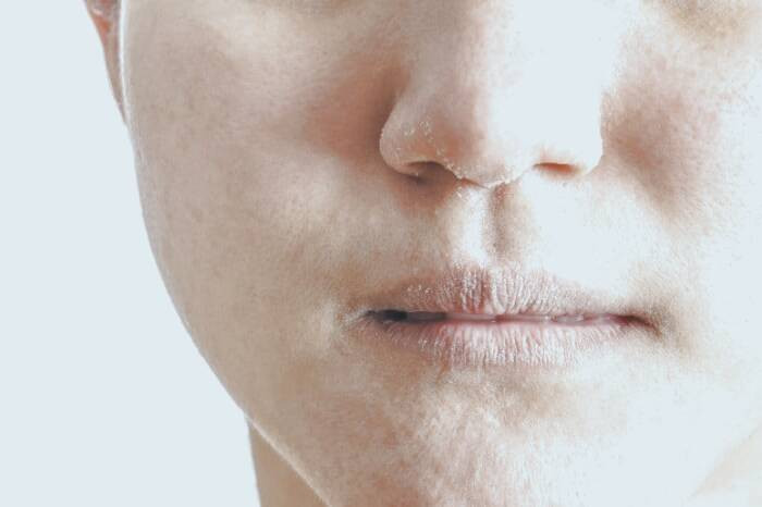 ترک خوردن لب