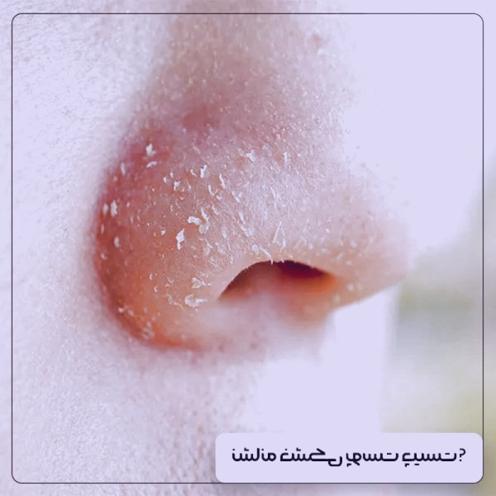 بررسی دلایل خشکی پوست و راهکارهای موثر برای درمان