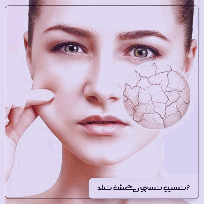 بررسی دلایل خشکی پوست و راهکارهای موثر برای درمان