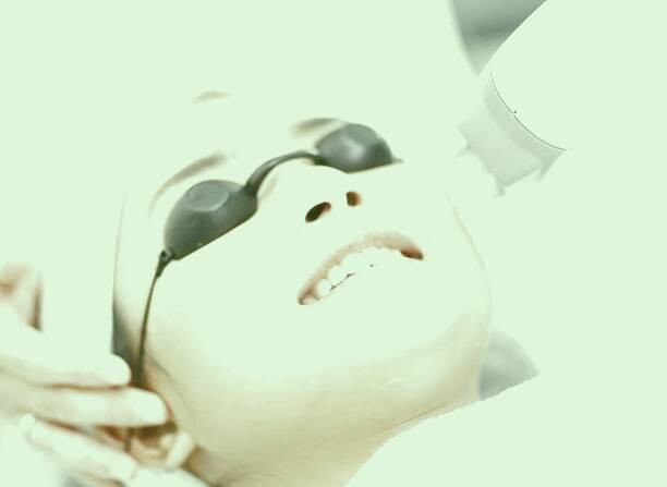 لیزر فرکشنال 