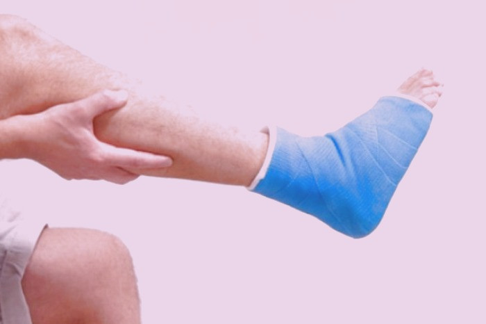 شکستن استخوان