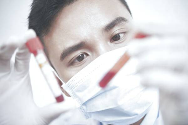  هموکروماتوز یا زیادی آهن