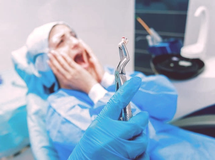 غذای بعد از کشیدن دندان عقل