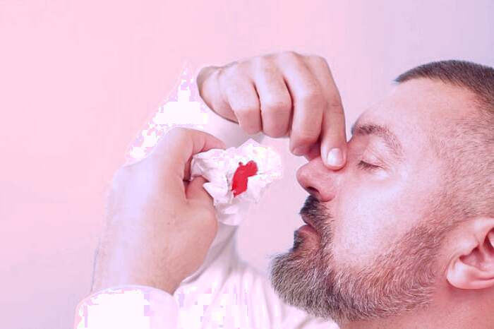 خون دماغ شدن