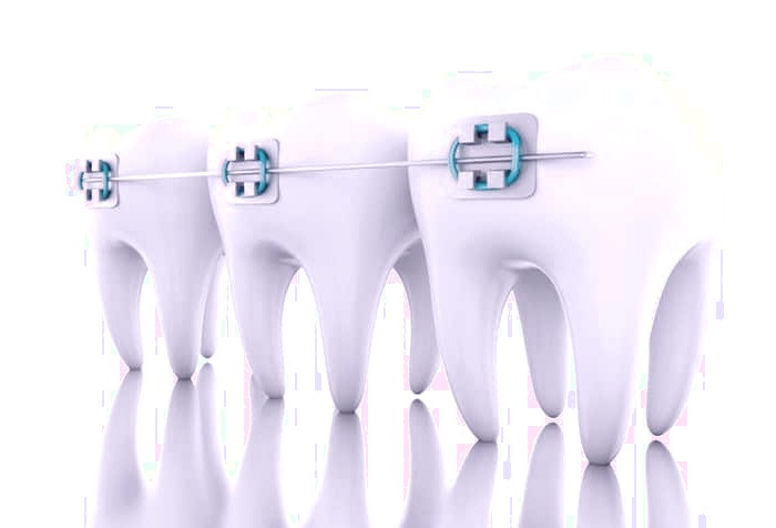 ارتودنسی و فواید آن 