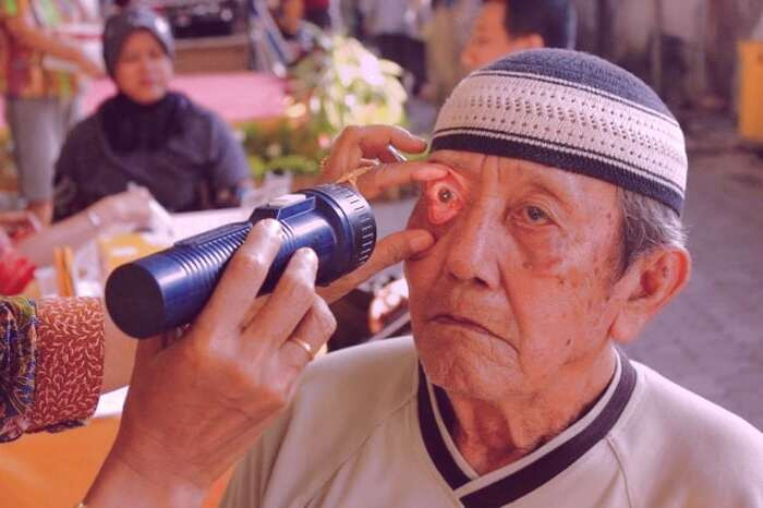 انواع آب مروارید