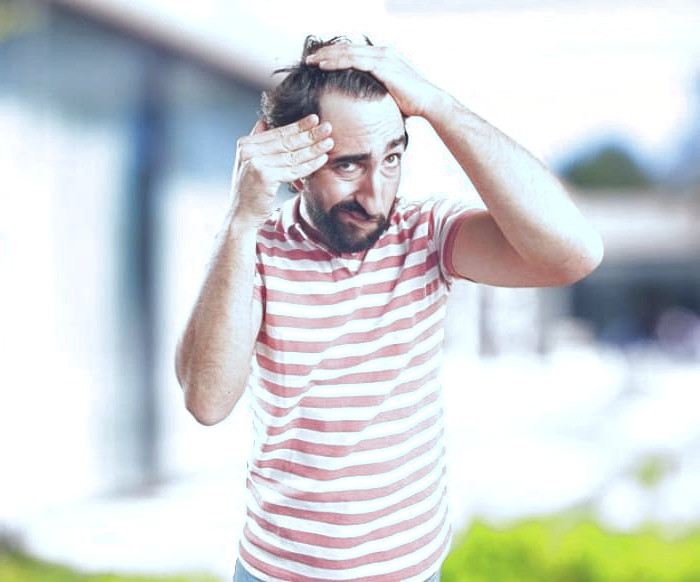 ریزش مو