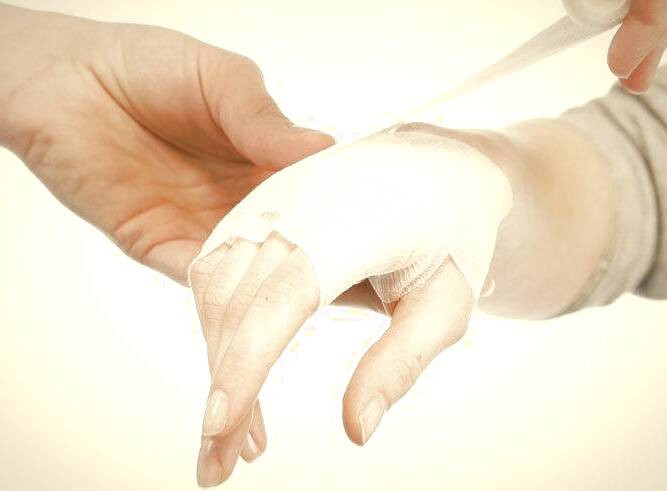 کمک های اولیه سوختگی