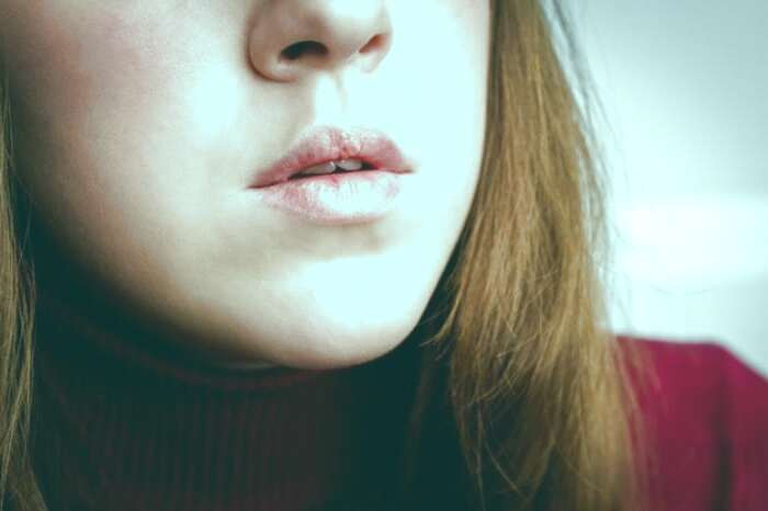 ترک گوشه های لب