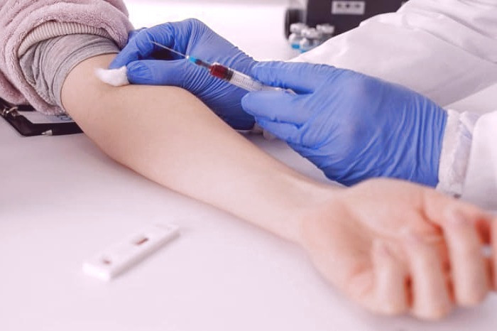 ویروس hiv