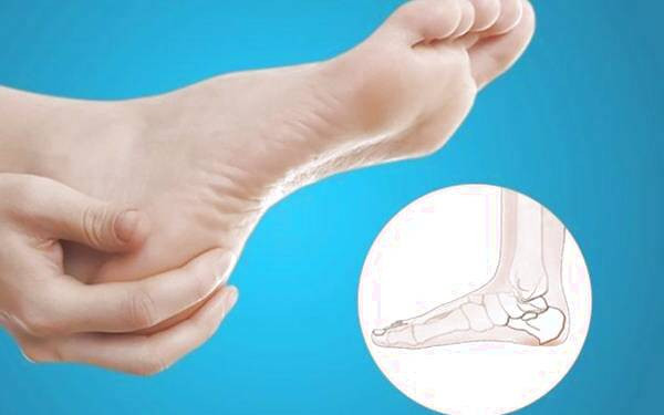 ایجاد خار پاشنه