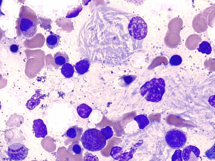 علت بیماری گوشه