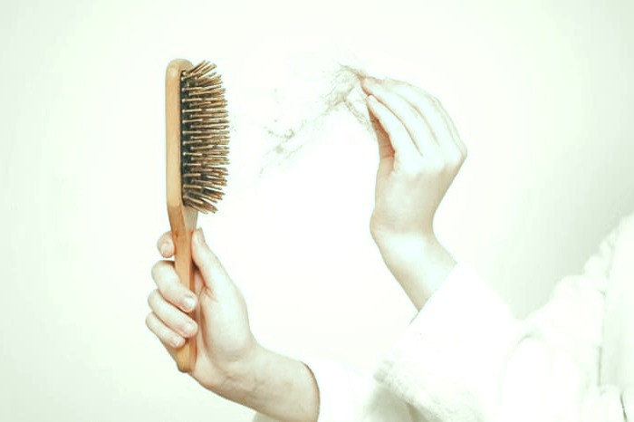 ریزش مو نوجوان