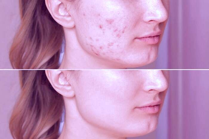 شستشوی صورت