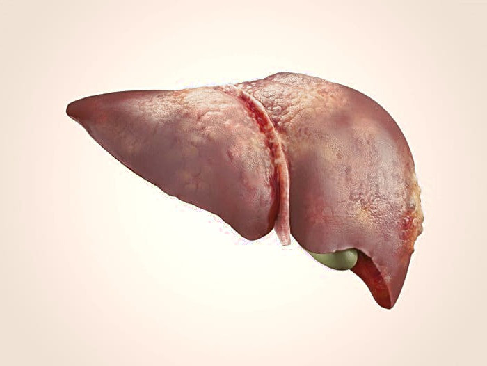 سلامت کبد با ترب سفید