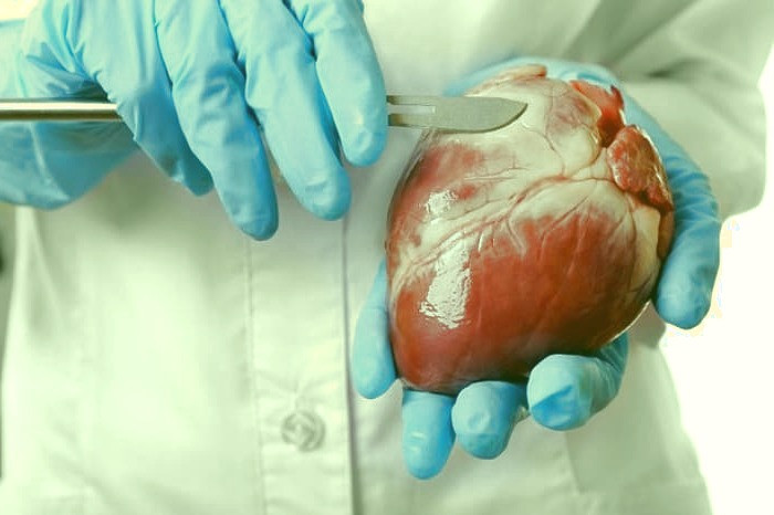 عمل قلب باز