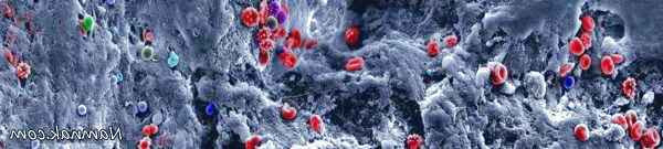 عکس سکته مغزی