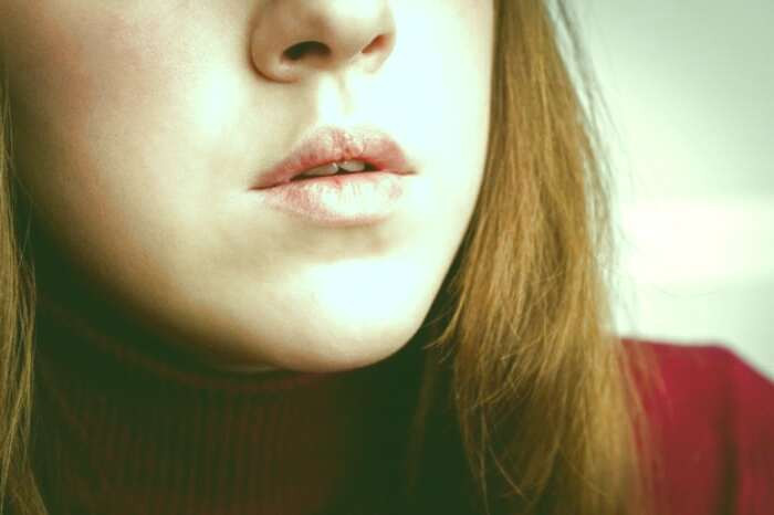 خشکی لب ها
