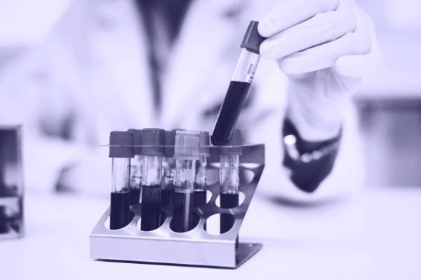 پایین بودن هورمون پرولاکتین