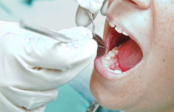 معیانه دندان