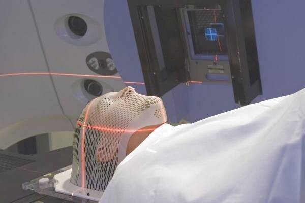 عوارض پرتو درمانی مغز تشعشع درمانی