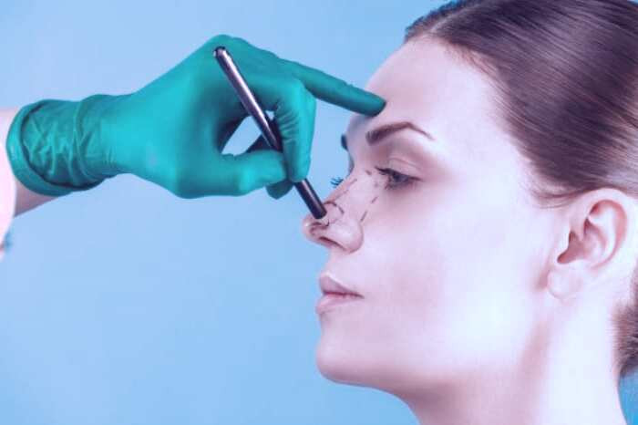 زیبایی بینی