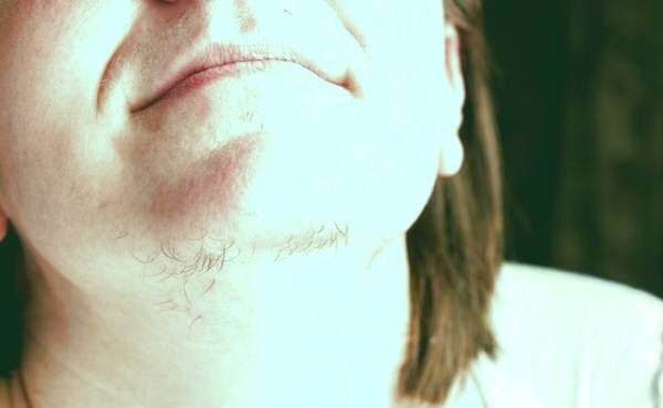 موهای زائد چانه