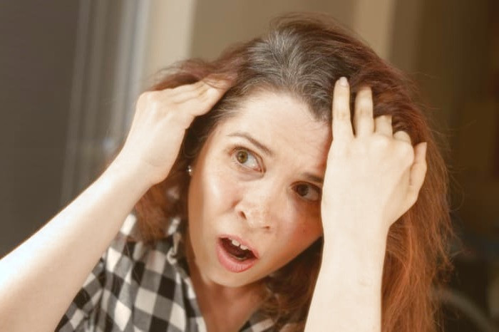 سفید شدن موها