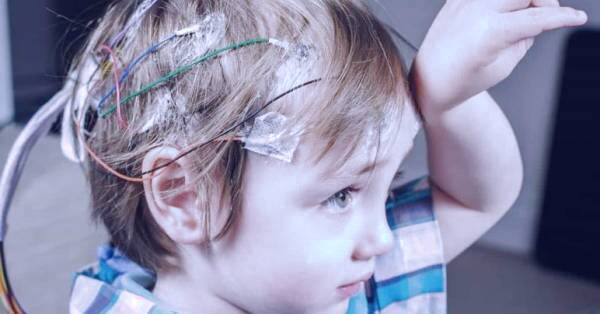 تشخیص صرع کودکان