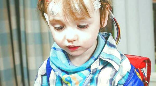 علائم صرع کودکان