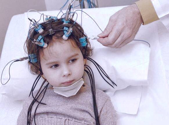 تشنج در کودکان