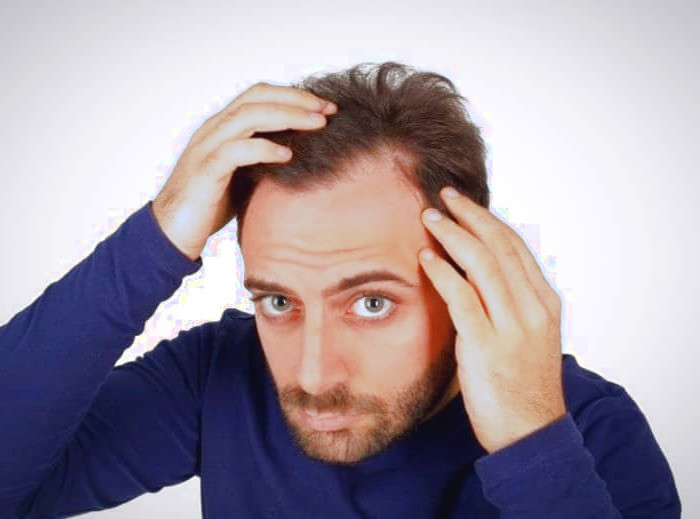 علت ریزش مو