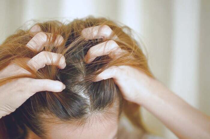 خارش و سوزش سر