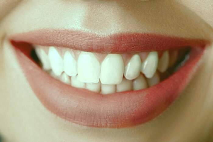 احتمال پوسیدگی دندان