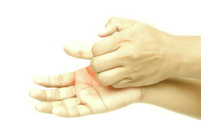خارش کف دست