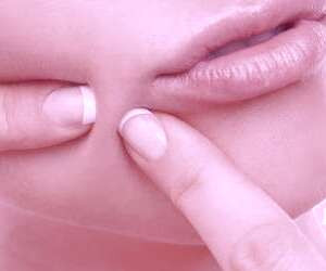 روش های مؤثر برای درمان جوش های زیر پوستی و خلاص شدن از آن‌ها + 12 راهکار