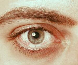 علائم بیماری شوگرن: خشکی چشم و دهان