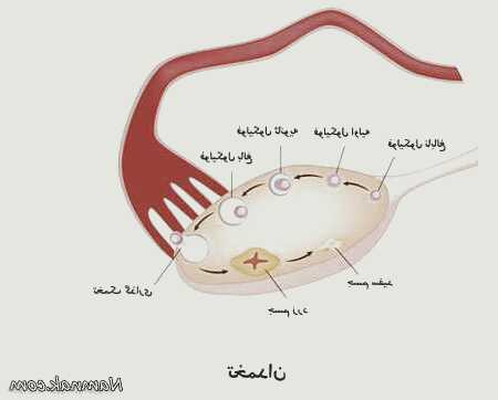 بیماری پیچ خوردگی تخمدان