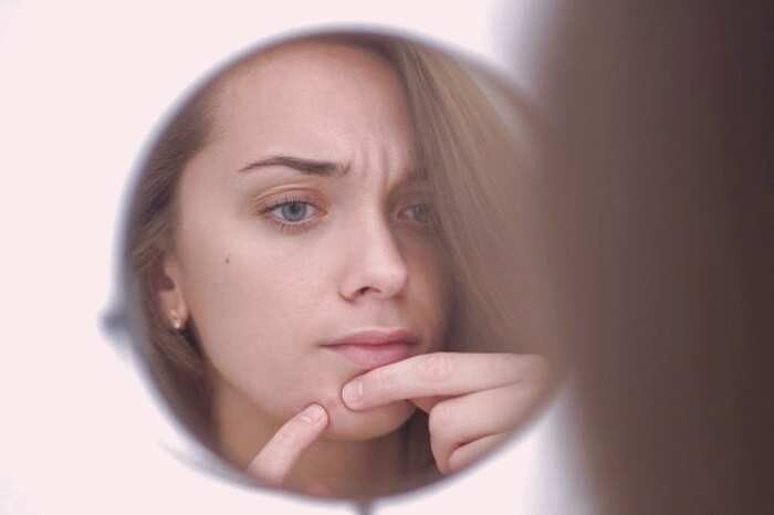 درمان جوش صورت