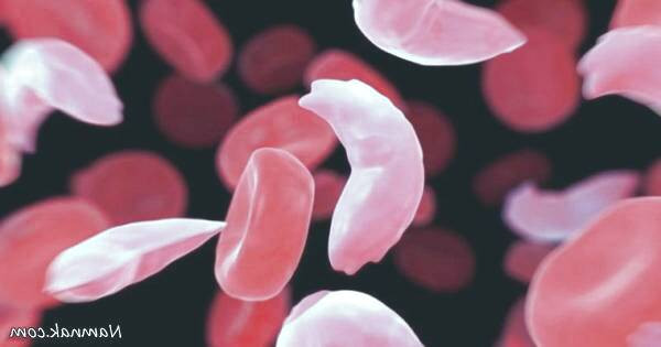 کم خونی آپلاستیک