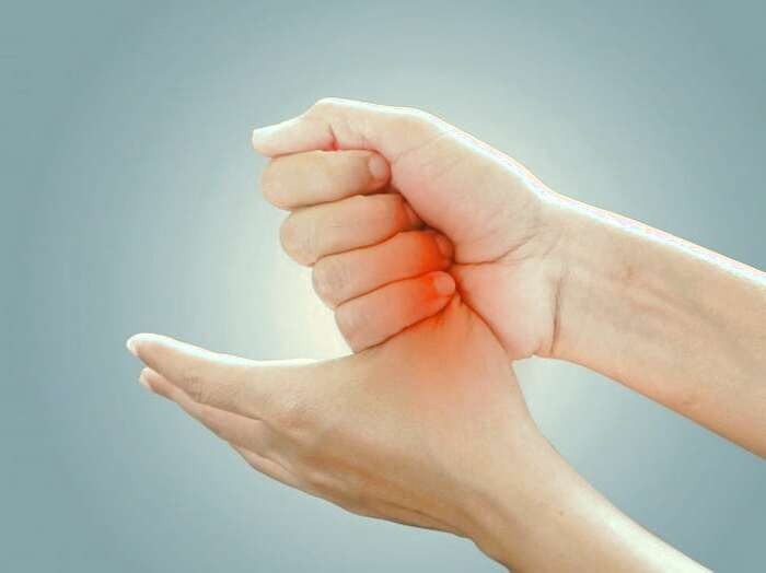 سندروم تونل کارپال