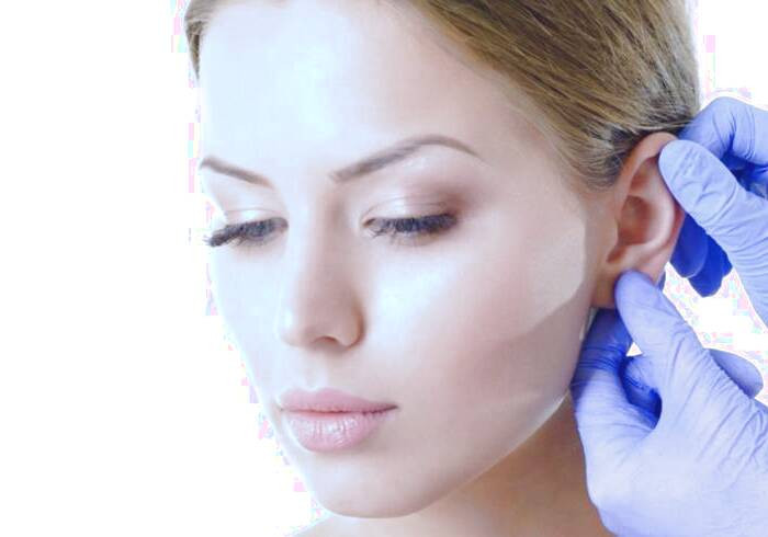 اوتوپلاستی