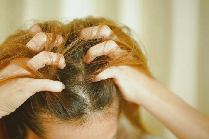 علت نازکی موهای سر زنان موهای نازک شده