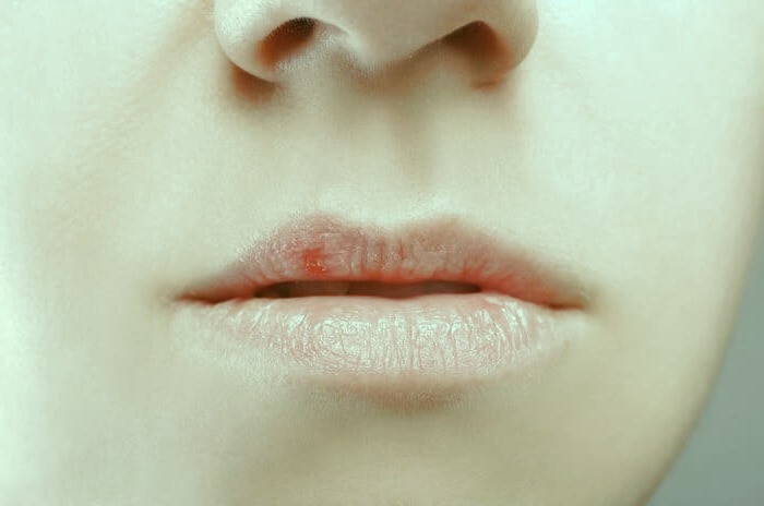 زیادی نمک بدن