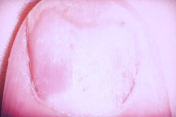 بیماری پوستی