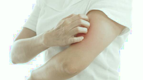 علائم خار استخوان