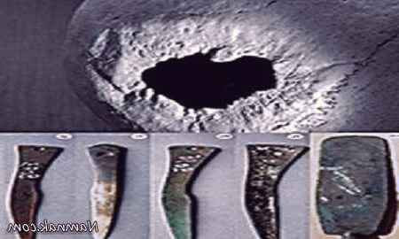 جمجمه سوراخ شده