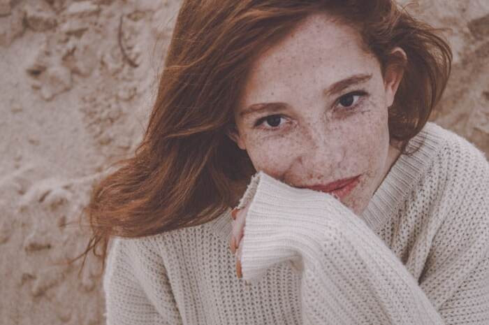 لک آفتاب سوختگی