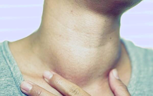 بیماری گواتر