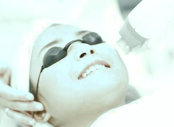 لیزر فرکشنال 